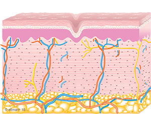 Collagen Remodeling Occurs